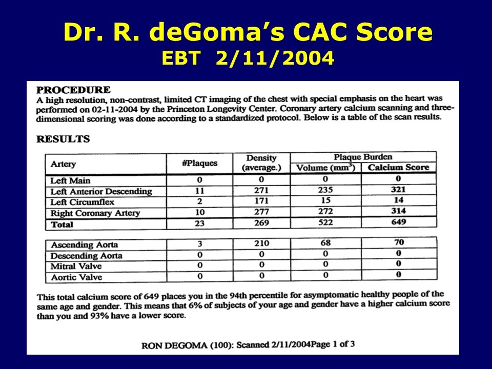 Dr deGoma CAC Score 2004